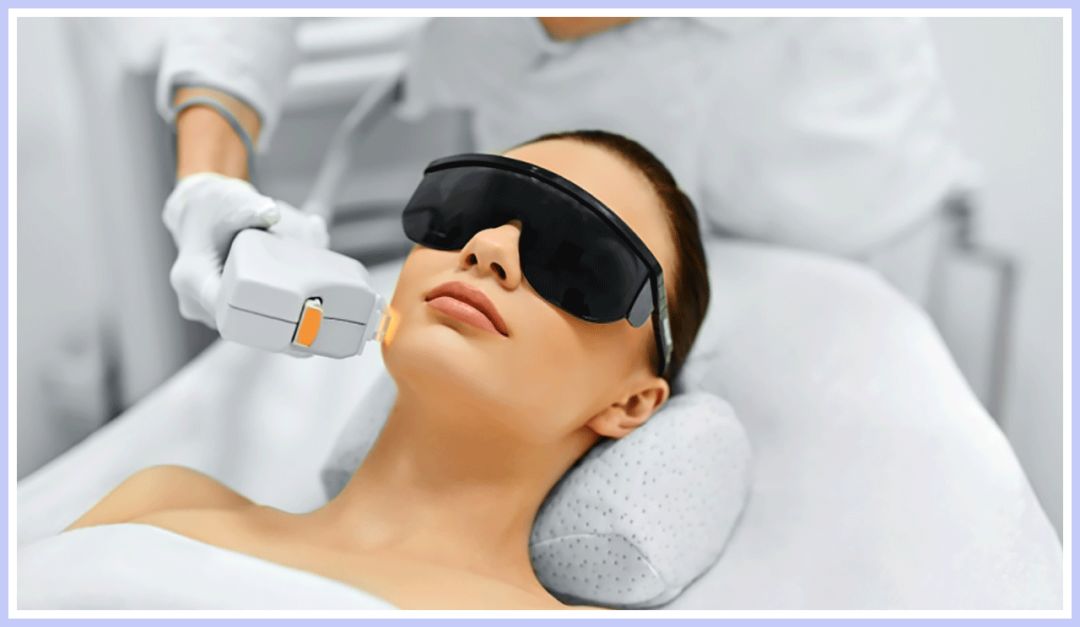 激光嫩膚儀安全等級認證(圖1)